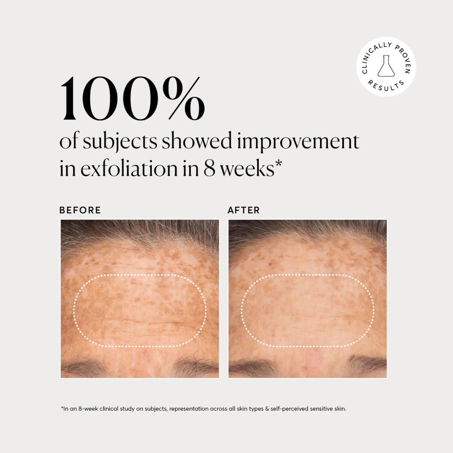 bha-liquid-exfoliant-2-l2 NATR-10027-Alt-Images-BHA-Liquid-Exfoliant-2_-03.webp